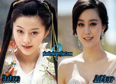 Fan Bingbing Plastic Surgery Before And After Photos Plastic Surgery