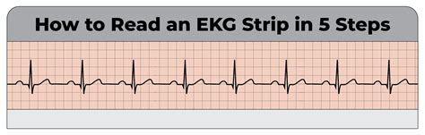read  ekg strip   steps cardiacdirect