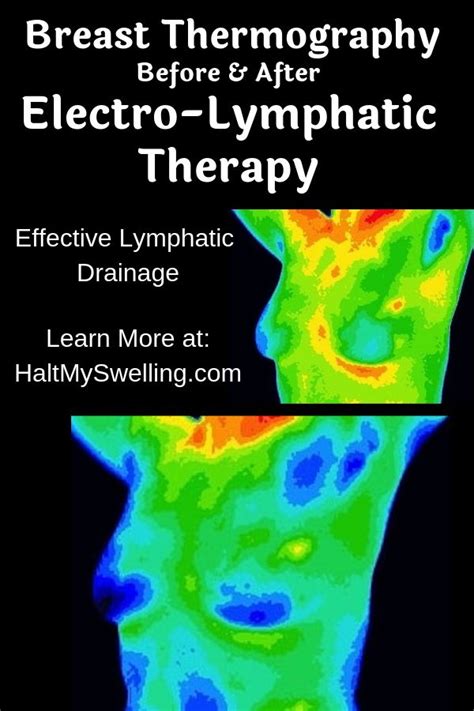 Pin On Lymphatic Drainage Lymphatic Massage