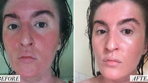 i tried a korean skin care routine for a month before and after