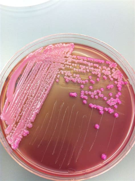 klebsiella  macconkey enterobacteriaceae microbiologia