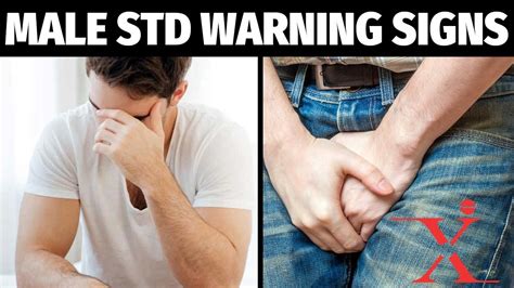 common stds warning signs and symptoms of viral stds youtube