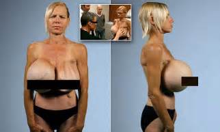 woman celebrates new breasts after having her 30lb