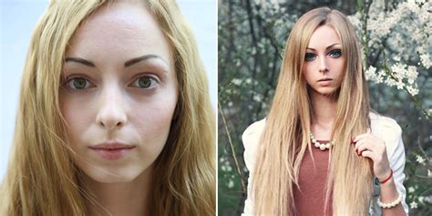 these people who had extreme plastic surgery will shock you