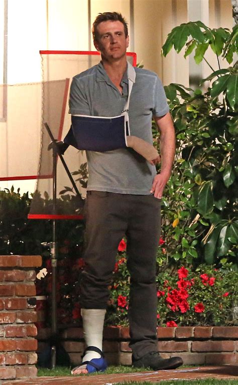Jason Segel Looks All Banged Up On Set—see The Pic E News