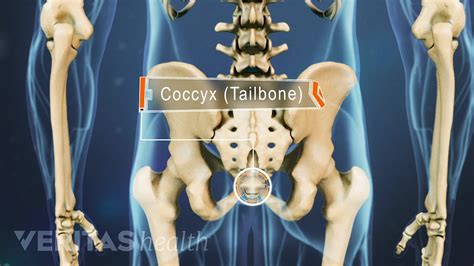 tailbone pain coccydynia   treatment vlrengbr