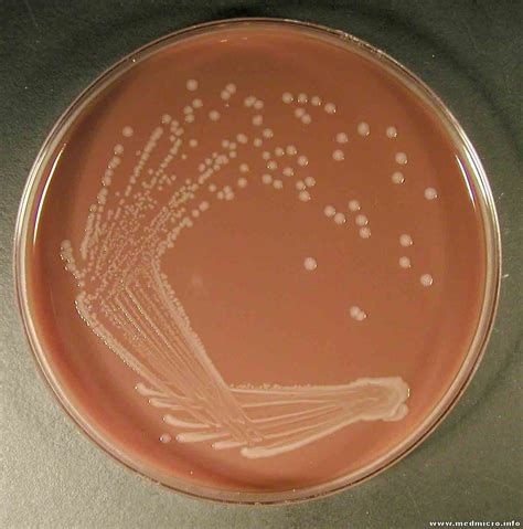 food science chocolate  plate microbiology  gram negative bacteria