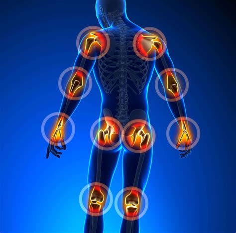 joint pain novus spine pain center  lakeland florida