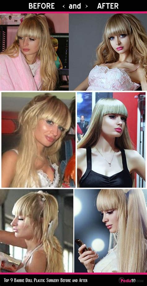 Top 9 Barbie Doll Plastic Surgery Before And After In 2020