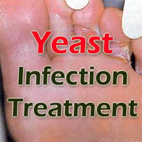 Healthgare Yeast Infection Treatment