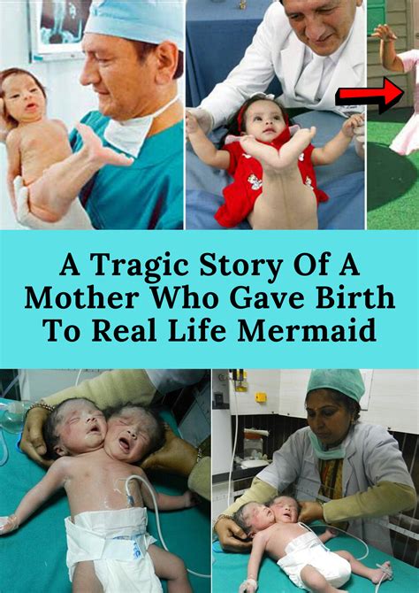 A Tragic Story Of A Mother Who Gave Birth To Real Life Mermaid Real