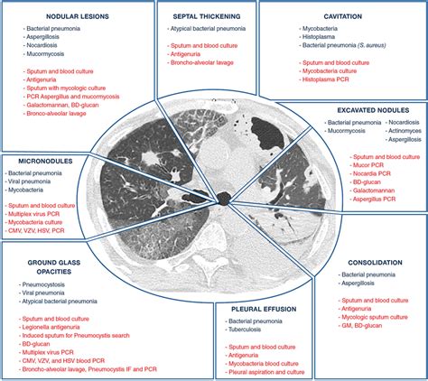 Etiologies Of Pulmonary Infections According To Ct Scan Patterns Cmv