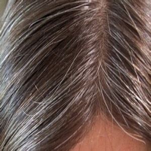 top  common hair problems