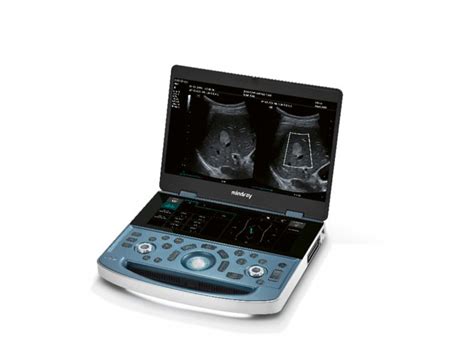 mindray mx ultrasound machine national ultrasound