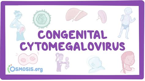 Congenital Cytomegalovirus Nord Osmosis
