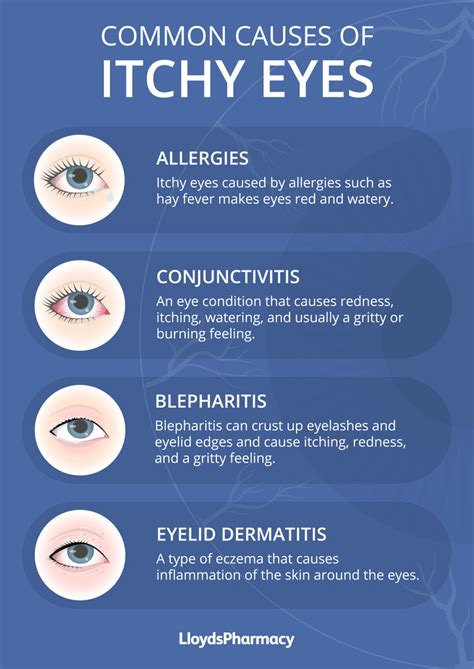 itchy eyes  treatment lloydspharmacy