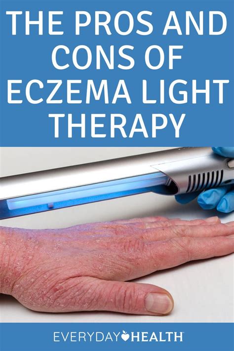 the pros and cons of eczema light therapy everyday