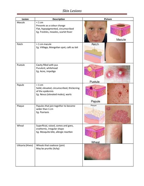 skin lesions