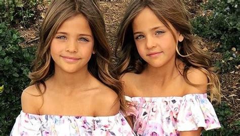 these twins were named “most beautiful in the world ” wait till you see