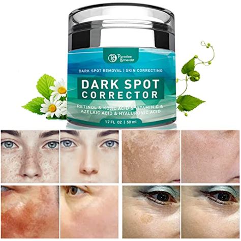 dark spot removal treatment review  buying guide blinkxtv