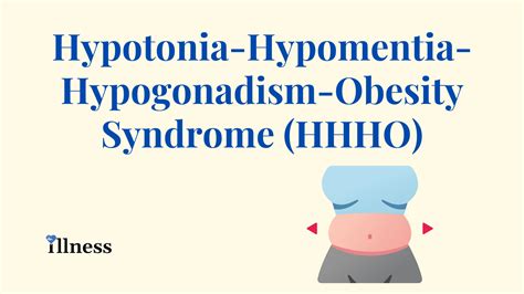 hypotonia hypomentia hypogonadism obesity syndrome hhho overview