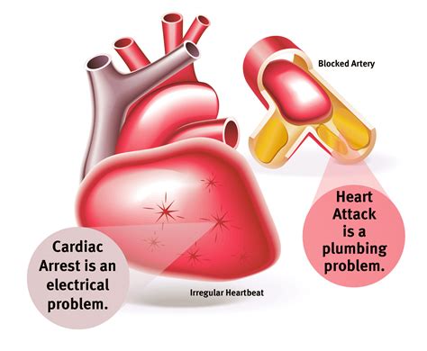 difference  sudden cardiac arrest  heart attacks