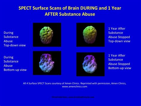 Here S To Neural Networks And Neurotransmitters Keys To