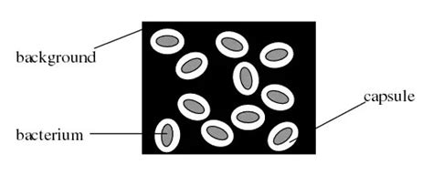 capsule stain principle procedure results microbe