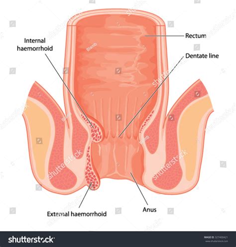 Cross Section Of The Rectum And Anal Canal Showing