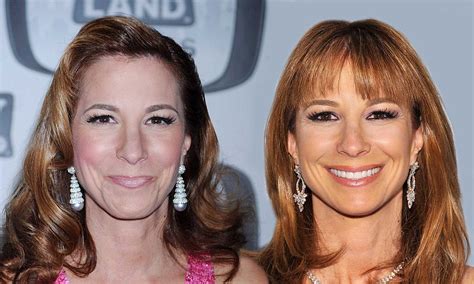 has real housewives of new york star jill zarin secretly had cosmetic