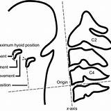 Hyoid Bone Measuring Lateral Schema Subjects Dynamics sketch template