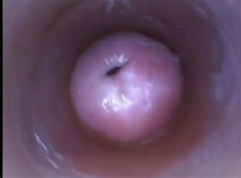 Vaginal Uterus And Intravaginal Ejaculation307 Porn 06