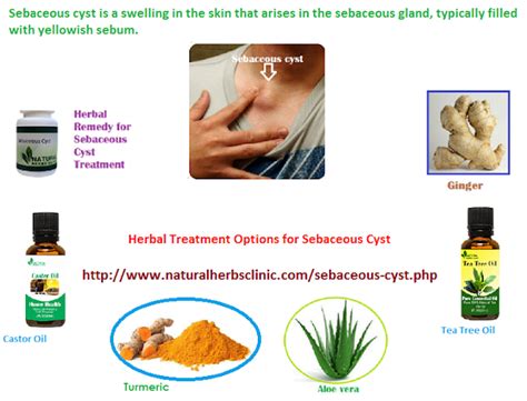 sebaceous cyst symptom and herbal treatment