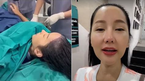 6 Potret Lucinta Luna Transplantasi Rambut Di Thailand Curhat Saat