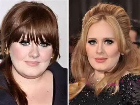 Adele Before And After Plastic Surgery 14 Celebrity