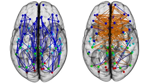 Men And Women S Brains Are Wired Differently Bbc News