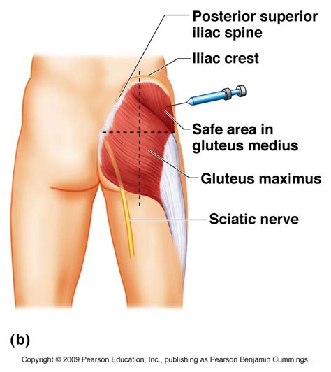 Gluteal Region Anatomy And Significance Bone And Spine