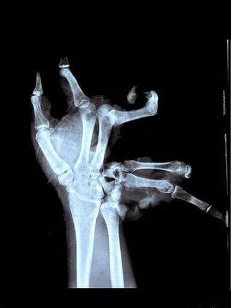 the weirdest xrays ever 18 pics curious funny photos pictures