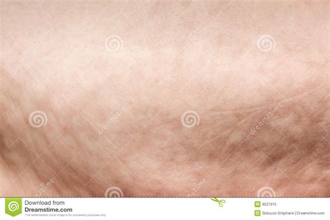 cellulite extreme macro stock image image of medicine 9521915