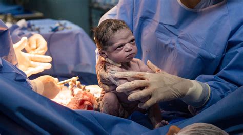 newborn baby  epic face  viral birth photo huffpost canada