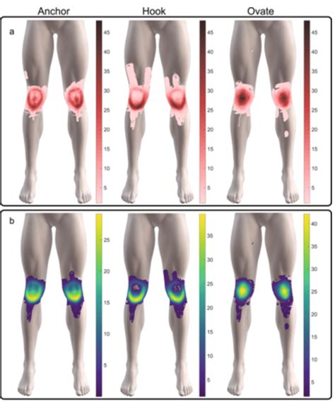 3 Patterns Of Knee Pain May Help Identify The Cause