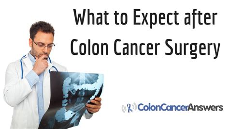 expect  colon cancer surgery youtube