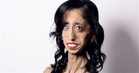 how being called the world s ugliest woman transformed her life