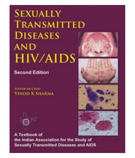 Sexually Transmitted Diseases And Hiv Aids 2 E Buy