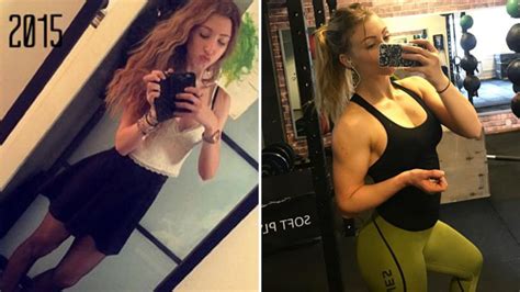 Anorexic Teenager Doubles Her Weight After Falling In Love With