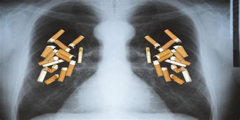 How Does Smoking Cause Lung Disease Lung Diseases