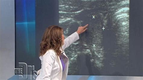 nodules  thyroid  doctors tv show