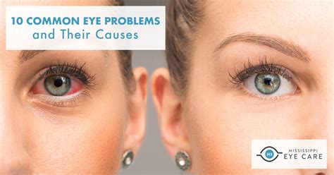common eye problems    mississippi eye care