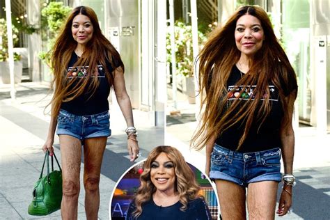 wendy williams fans fear for ailing host s health after she shows off