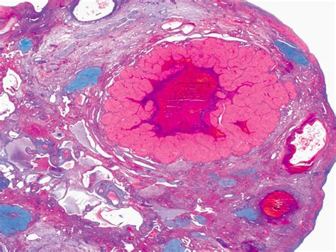 corpus luteum ovary histology
